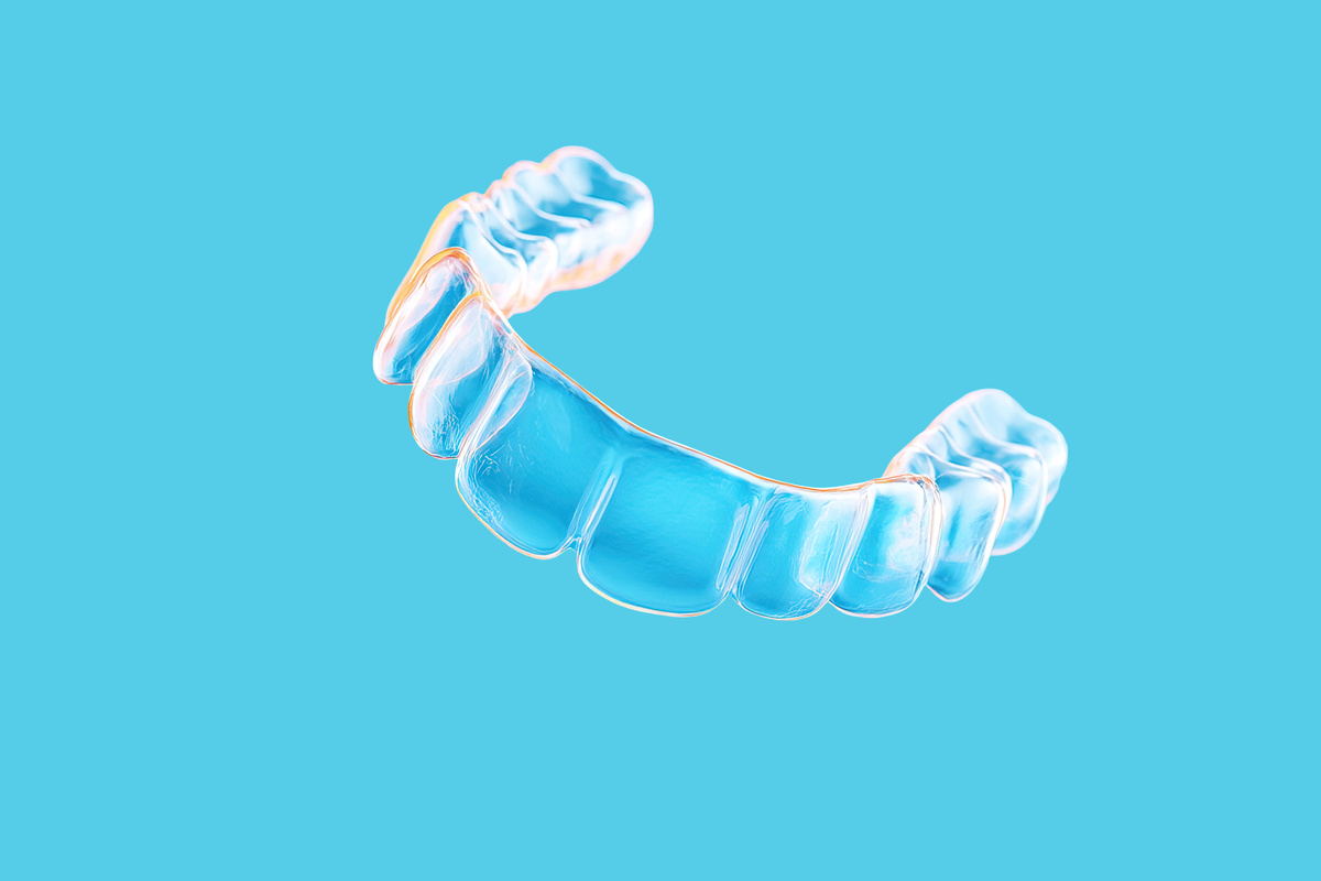 Custom mouthguard for sports protection and comfort