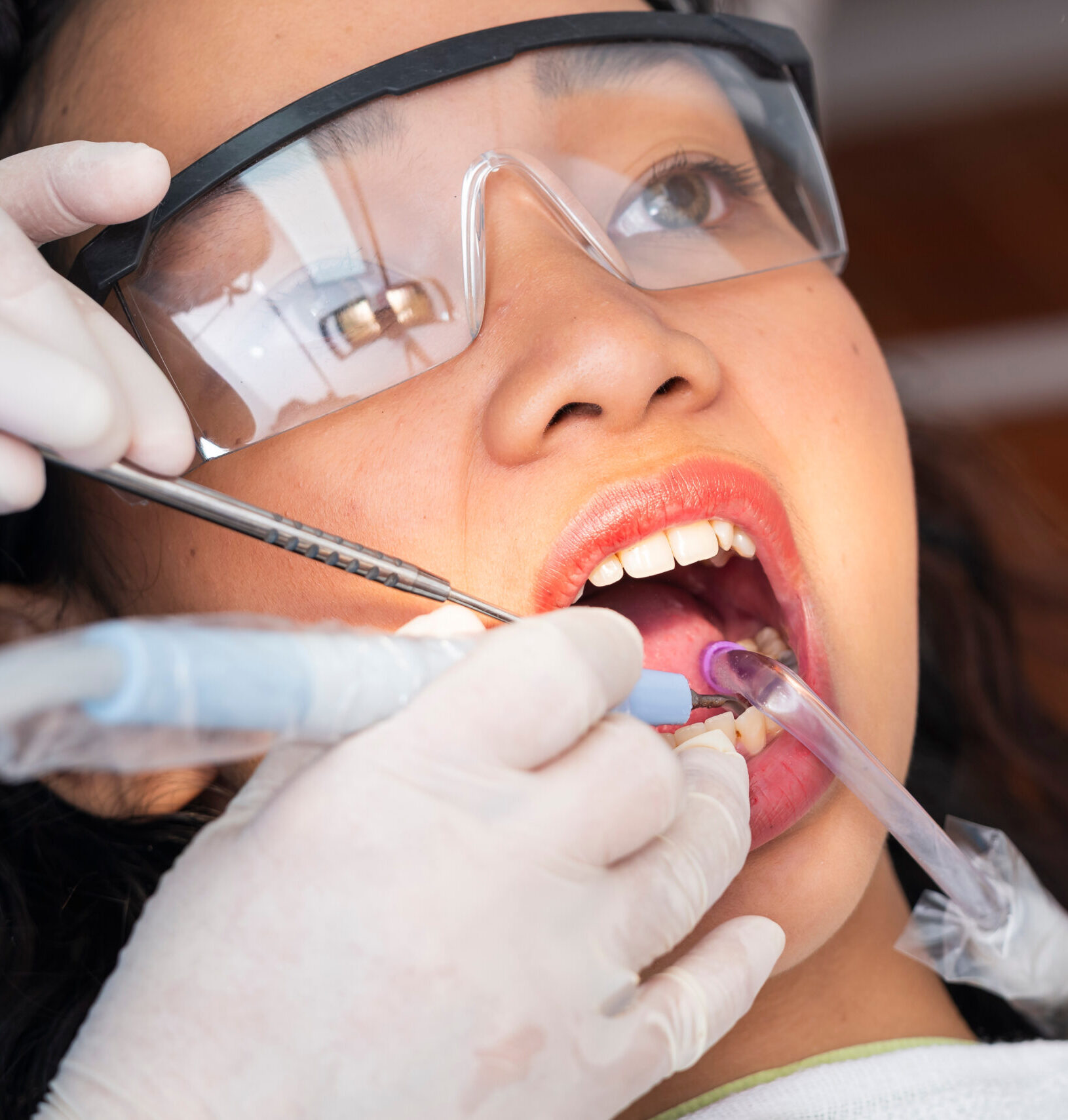 Dental professional performs ultrasonic scaling and suction on a young woman during a routine oral prophylaxis procedure in clinic.