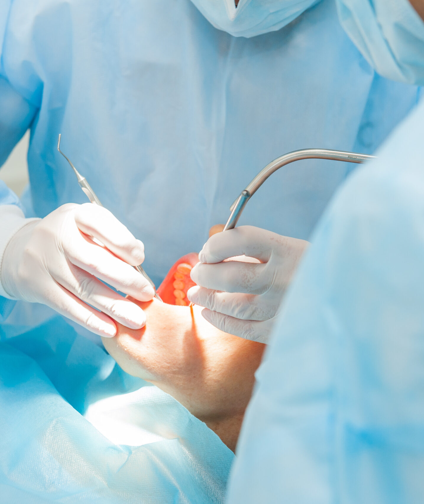 Close up dental surgery process - Implantation. Dentist surgeon with assistant in modern clinic. Stomatology and health care concept. selective focus. Space for text.