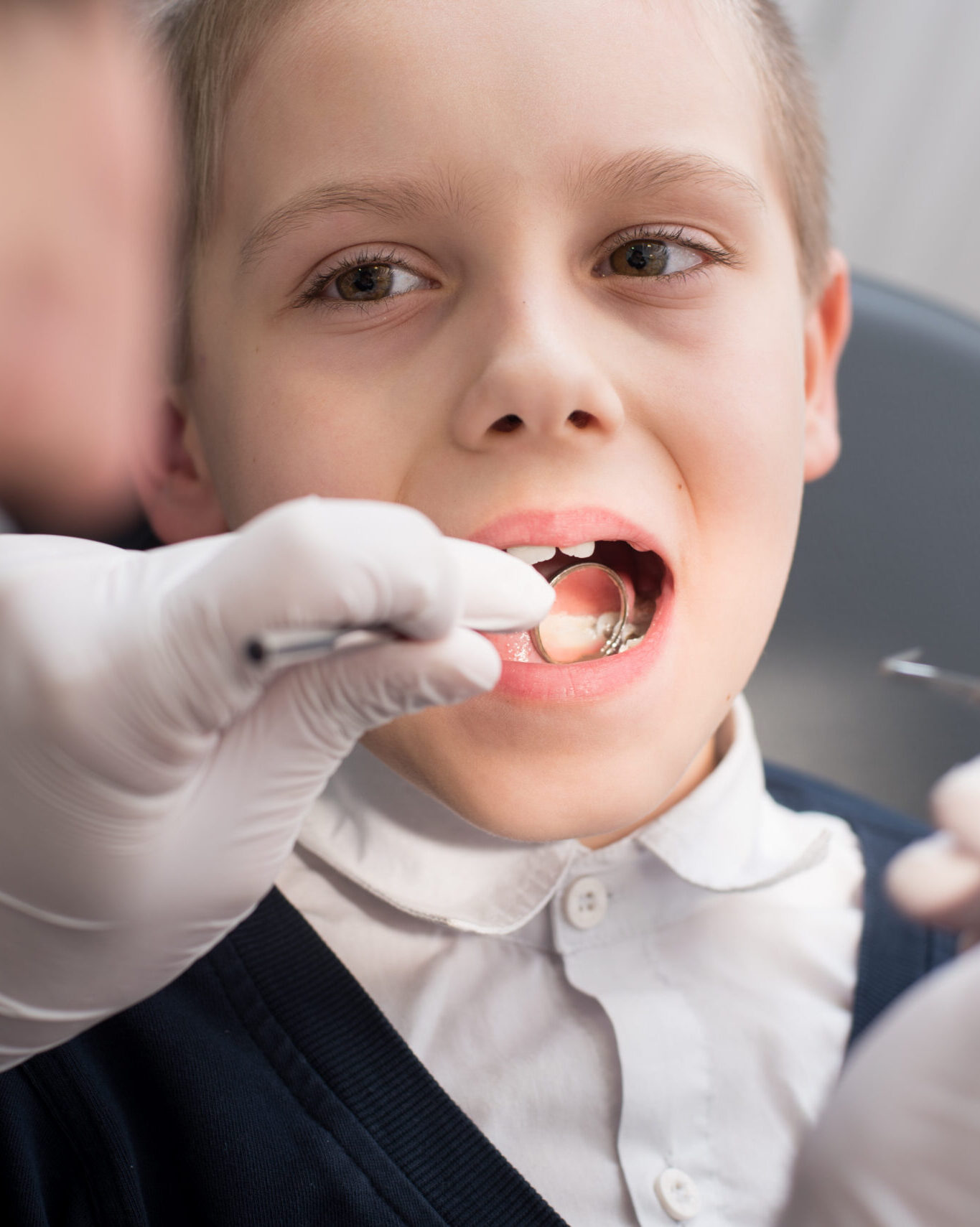 Close-up dentist examining teeth of boy patient in dental clinic using dental tools - probe and mirror. Dentistry