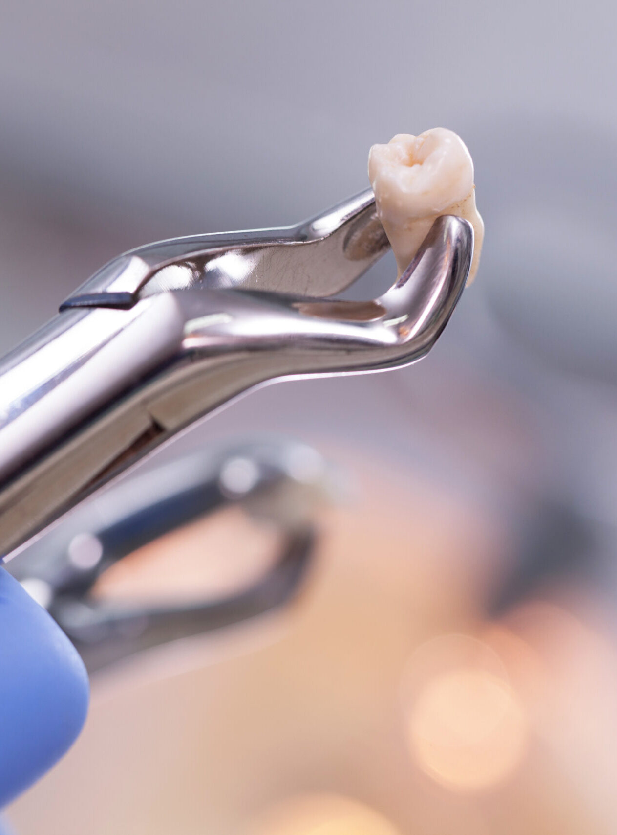 Dental equipment holding an extracted tooth
