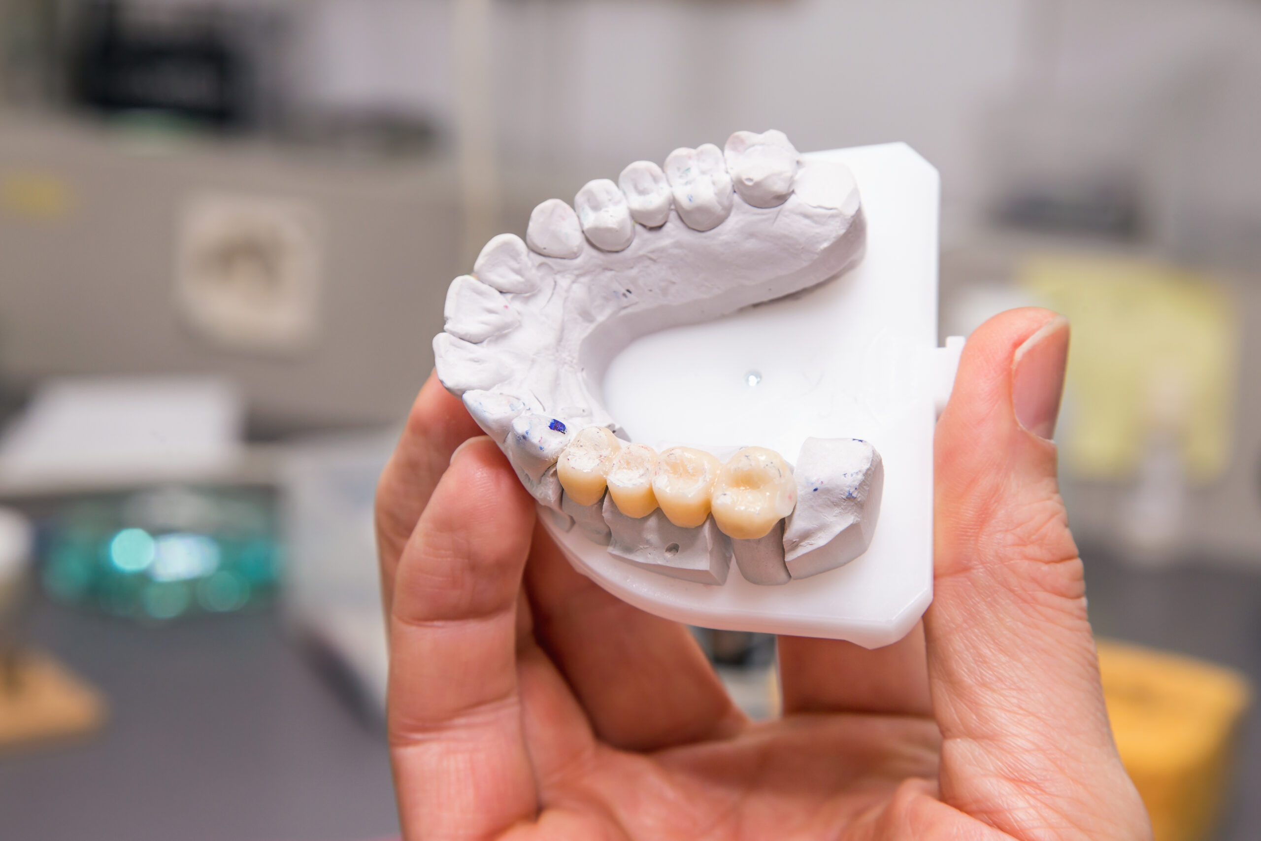 Technical shots of model on a dental prothetic laboratory.Dentist hand with plaster model