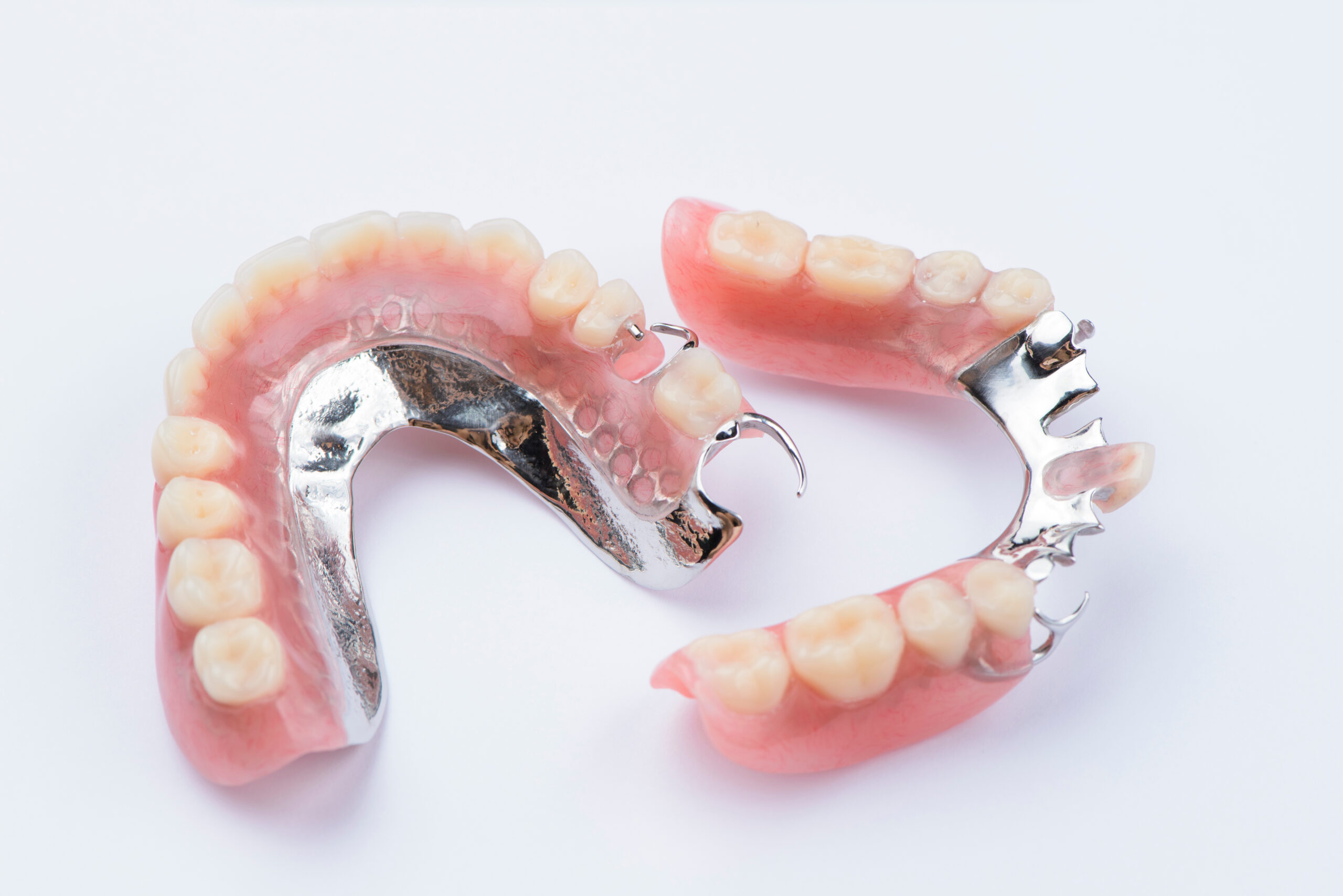 Removable metal partial denture on white background