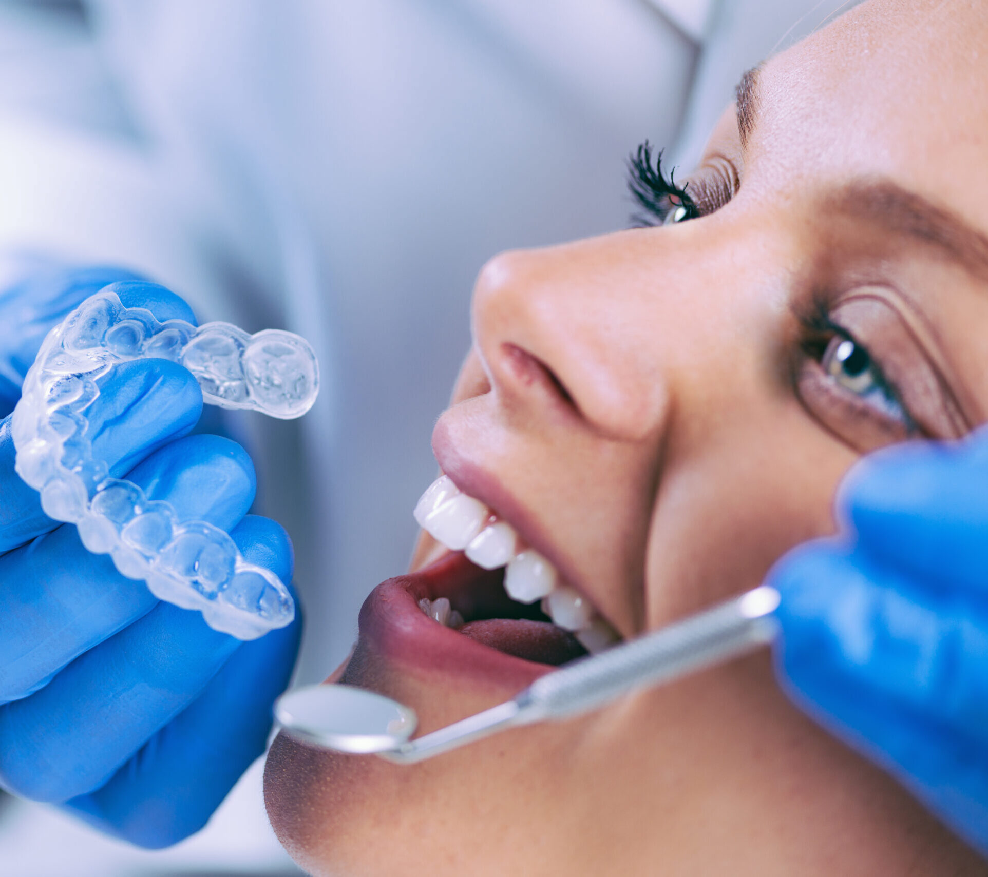 Teeth Whitening Procedure