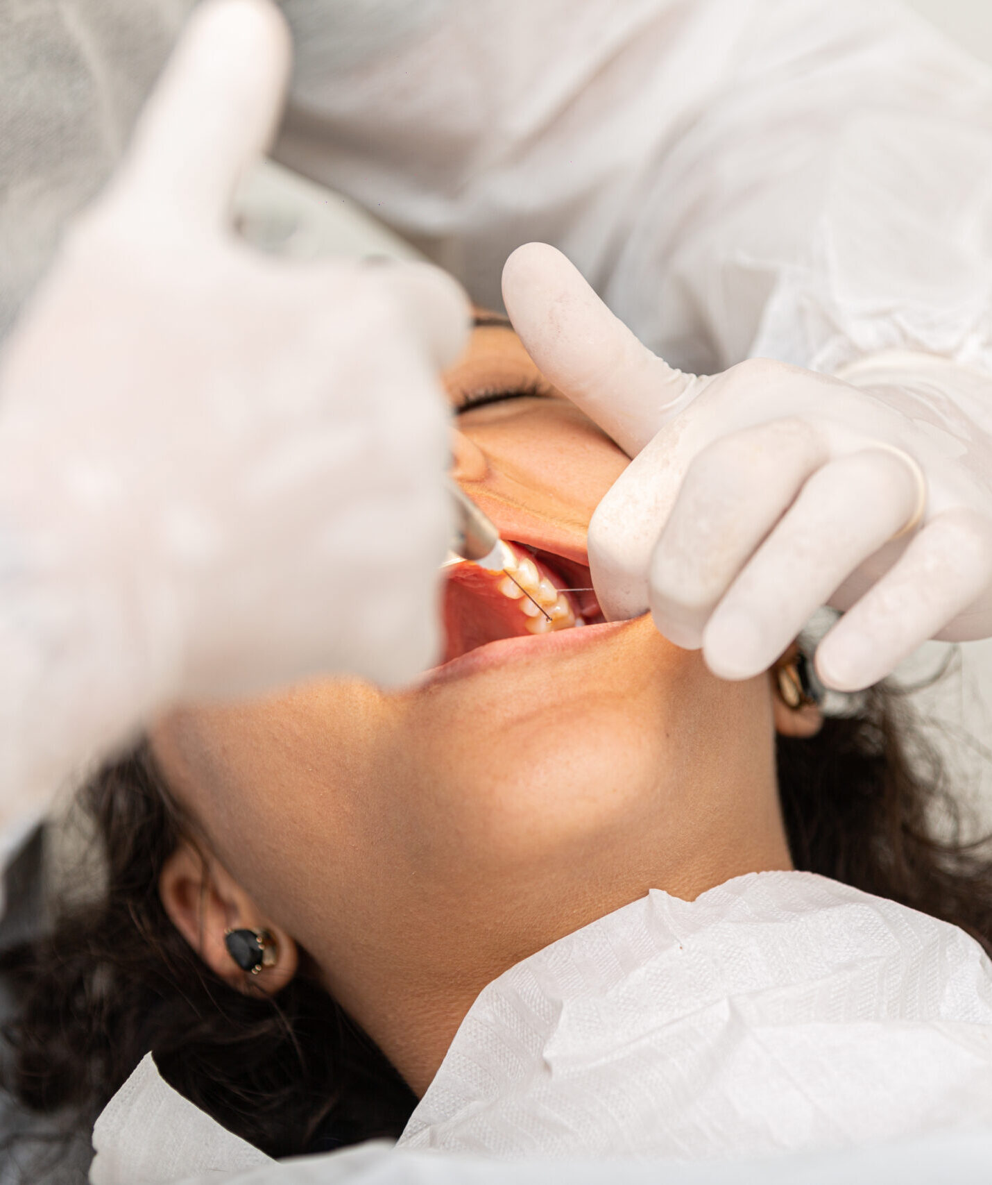 Young woman being seen in a dentist's office. Concept of toothache, wisdom tooth extraction, anesthesia, problems with caries or gums. Oral health care. Dentist day.