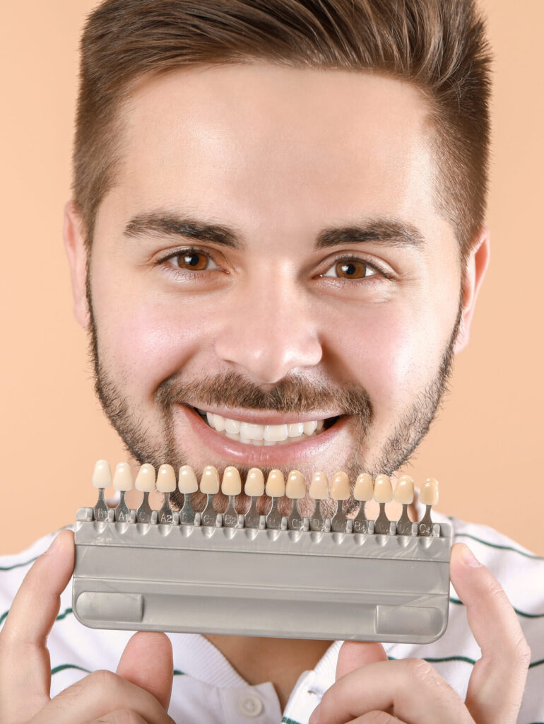 Young man with teeth color samples on beige background