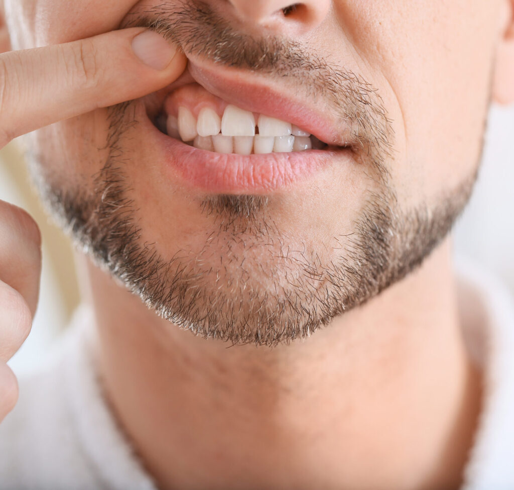 Man suffering from tooth ache in morning, closeup