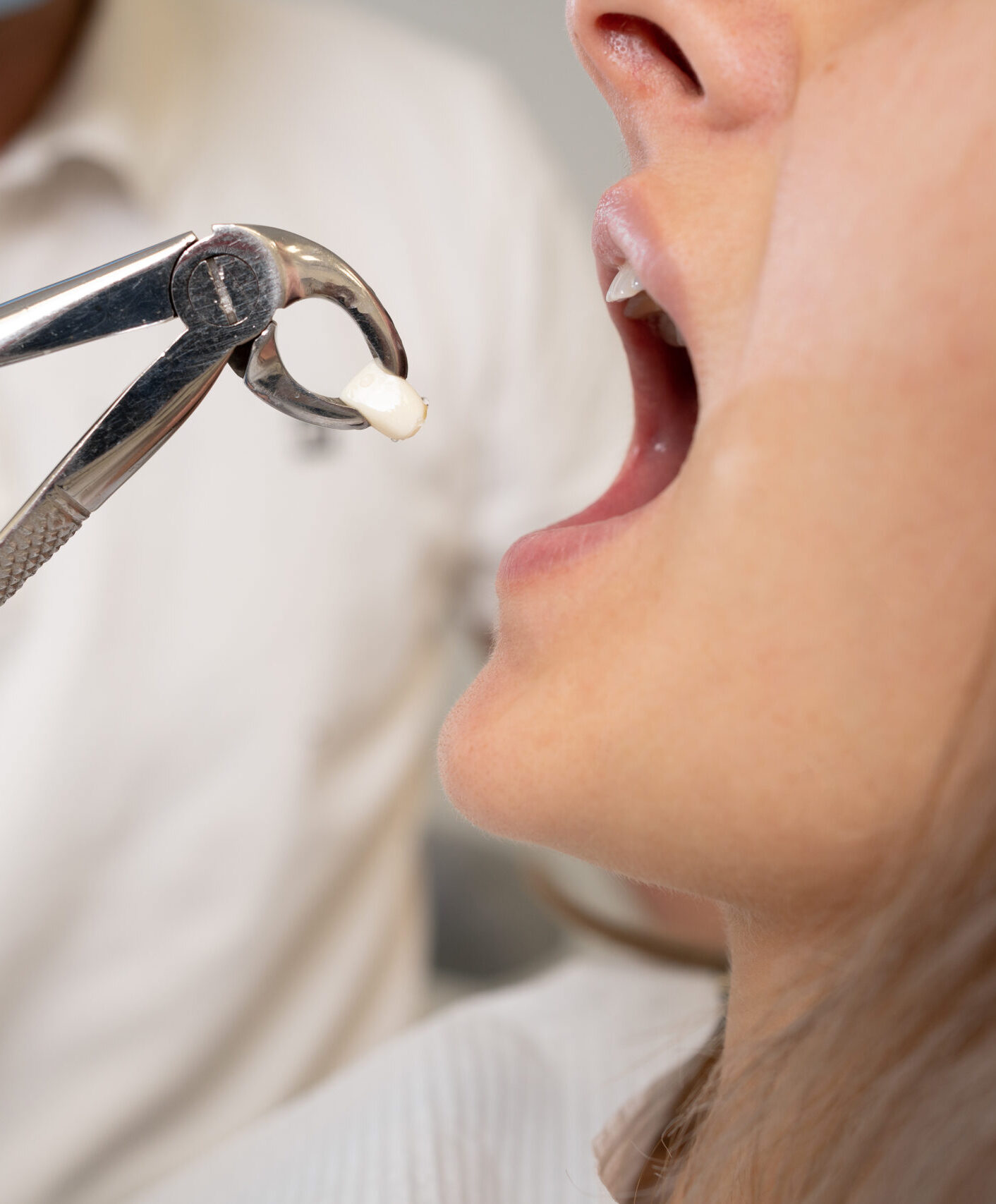 close-up of forceps for extraction of teeth and a tooth in them. The concept of going to the dentist. copy space.