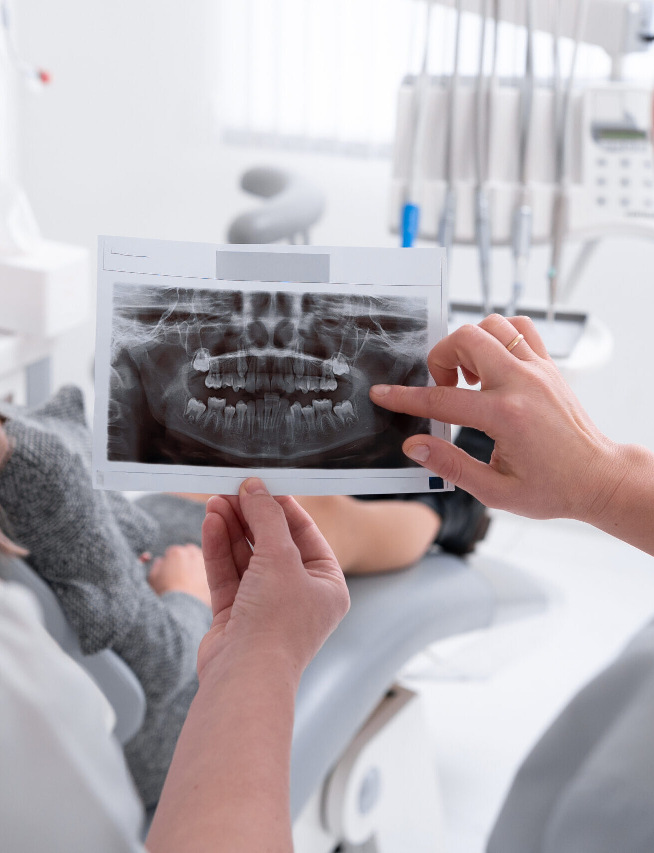 female dentist looks at an x-ray of the patient's teeth, doctor says which teeth to treat. Modern dental office. x-ray of the jaw in the hands of a dentist