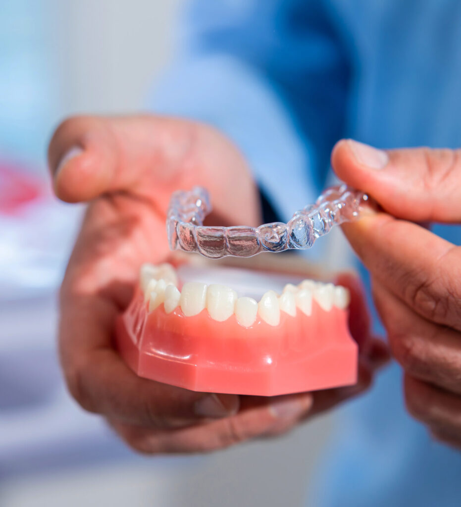 Close-up. The doctor puts transparent aligners on the teeth of the artificial jaw