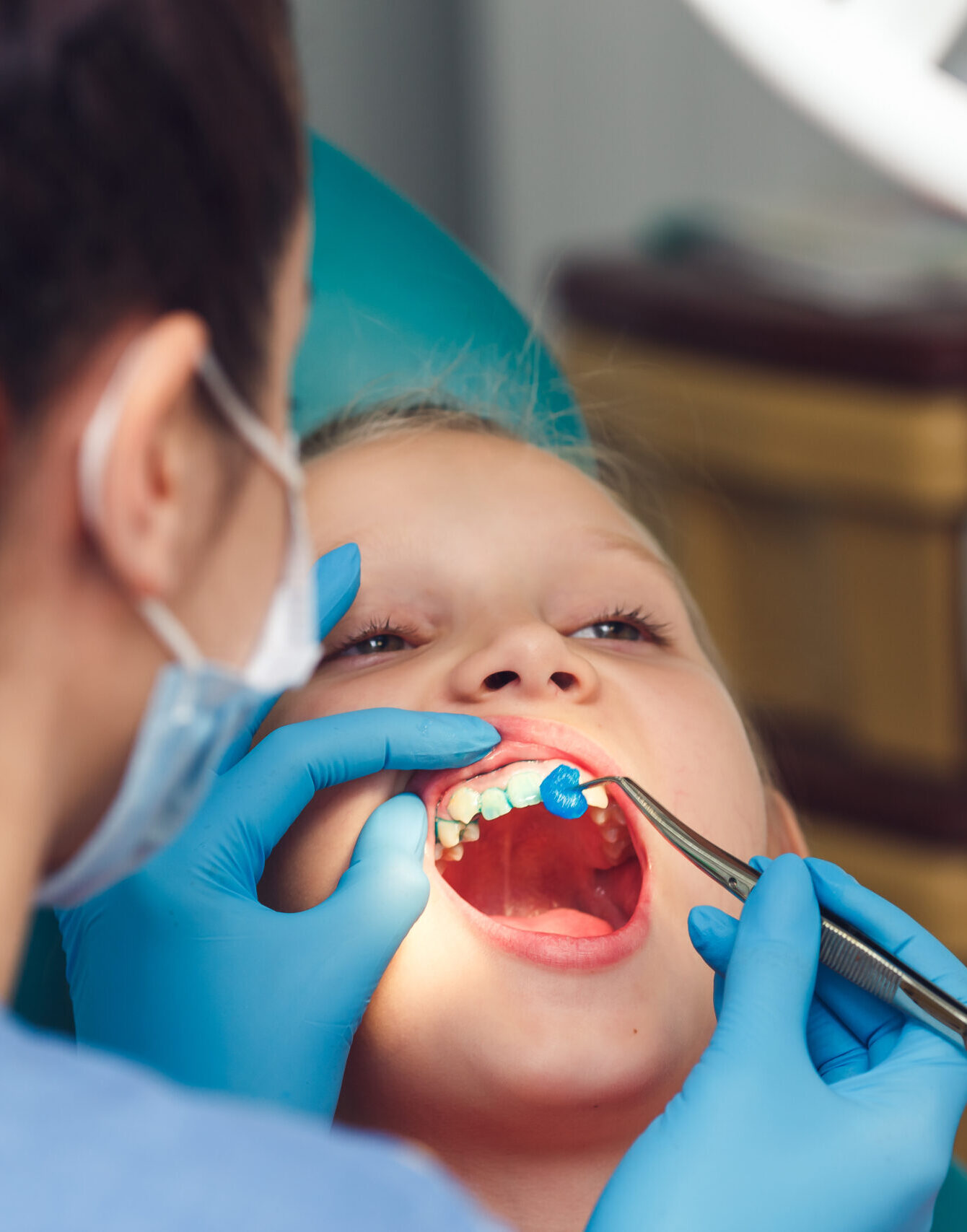 dentist fluoridates a child's teeth. Strengthening of tooth enamel