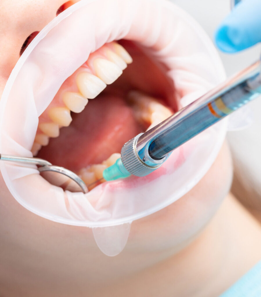 The dentist injects an anesthetic into the patient's inner cheek. Anesthetic drug in dentistry.