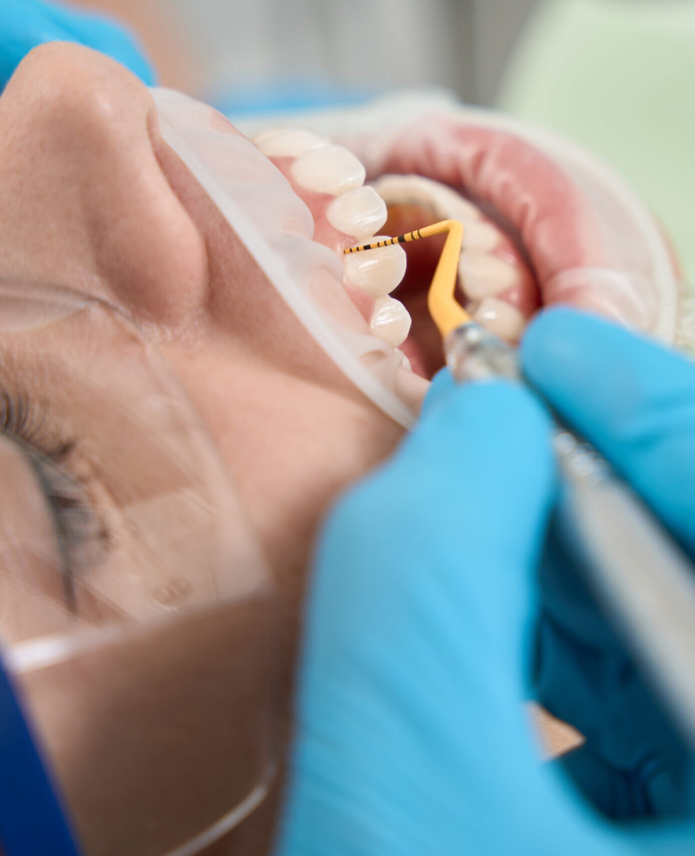 Doctor hands removing tartar from tooth surface and underneath gumline of female patient