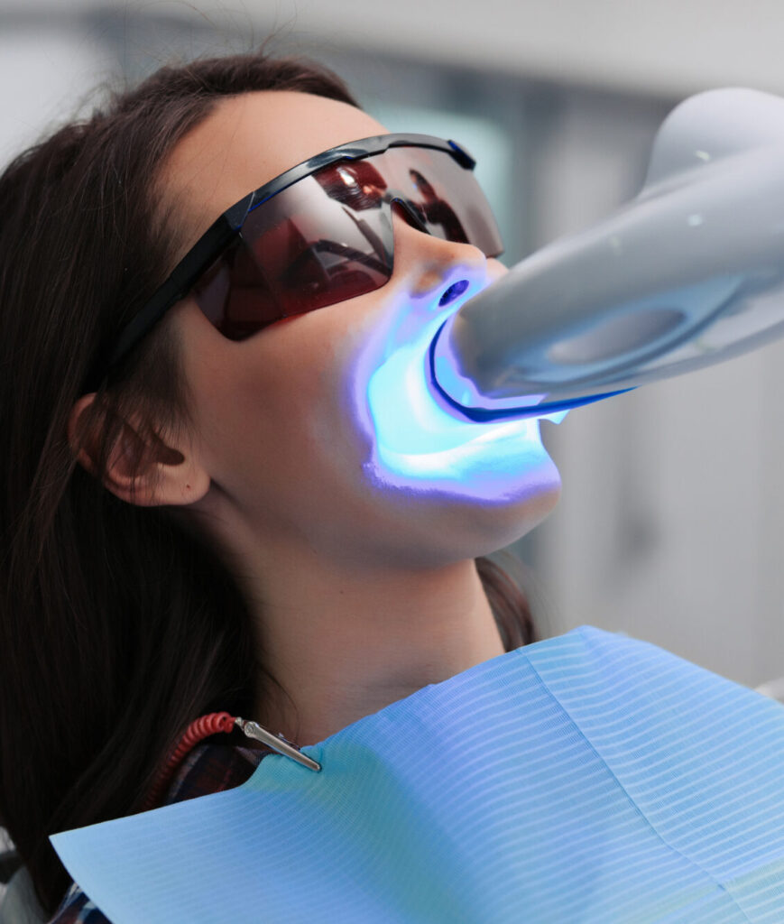 Teeth whitening for woman. Bleaching of the teeth at dentist clinic.