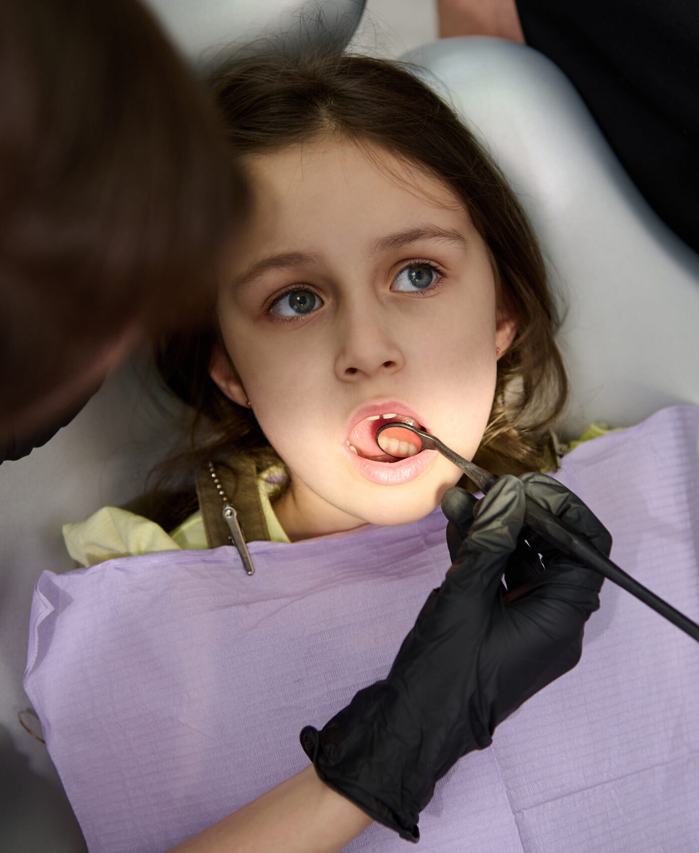 Close-up Caucasian little child girl with open mouth, is being examined by a dental hygienist, dentist doctor in pediatric dentistry clinic. Dental light directed at her oral cavity. Dental practice