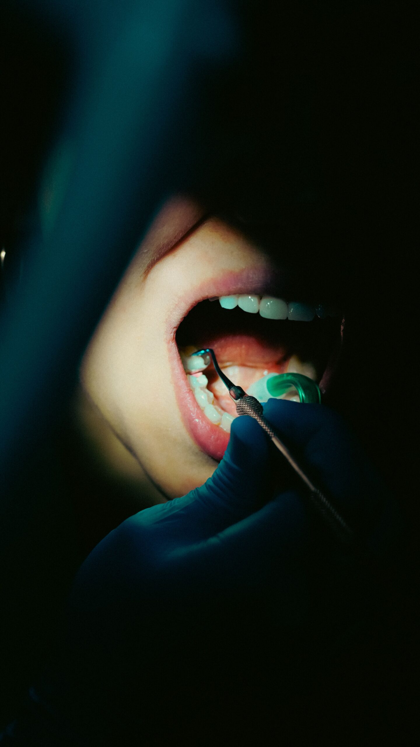 Dental examination of adult patient with dental tools at White Pine Family Dental Reno