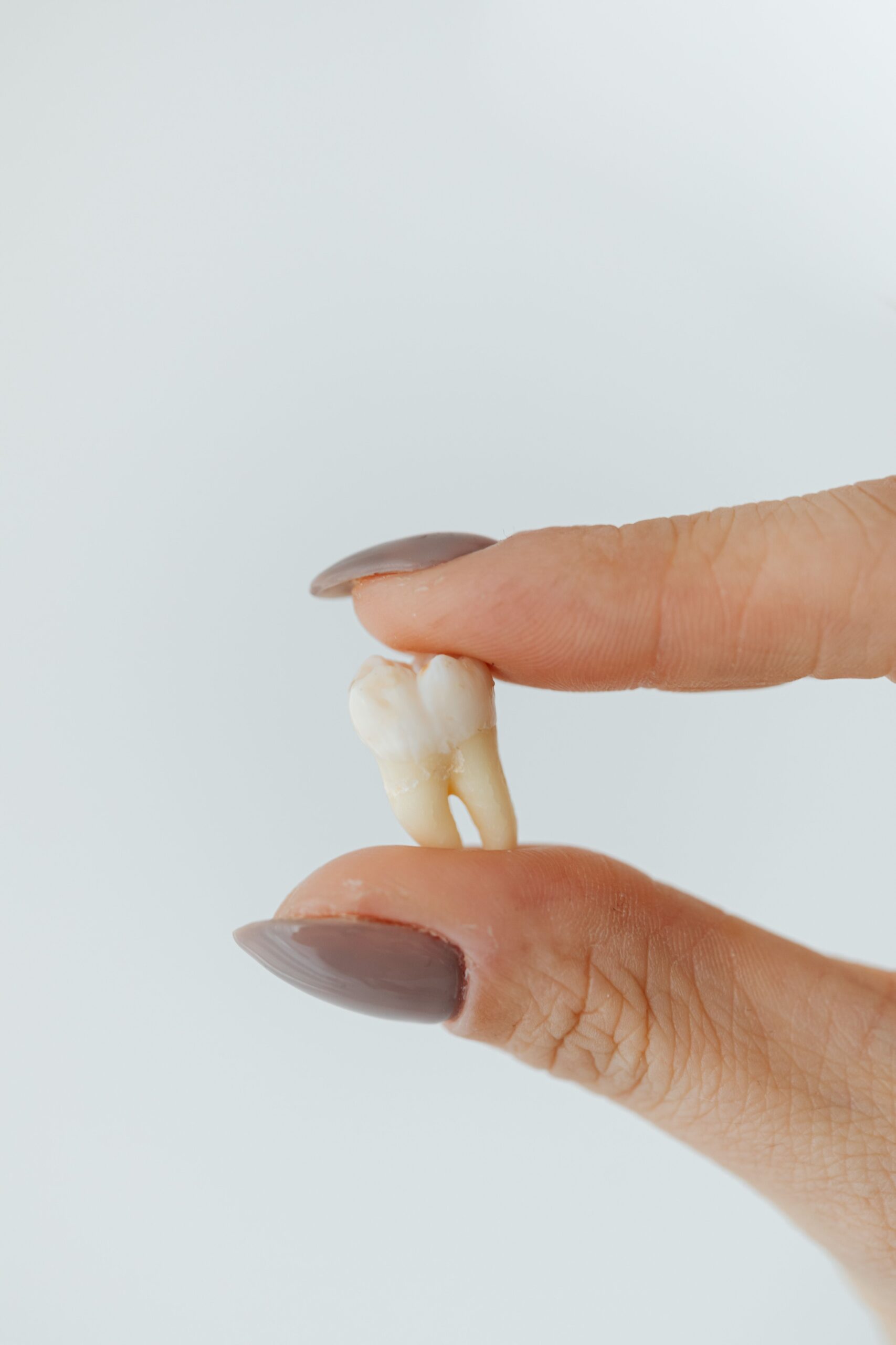 Knocked-out adult tooth dental emergency in Reno NV - call White Pine Family Dental immediately