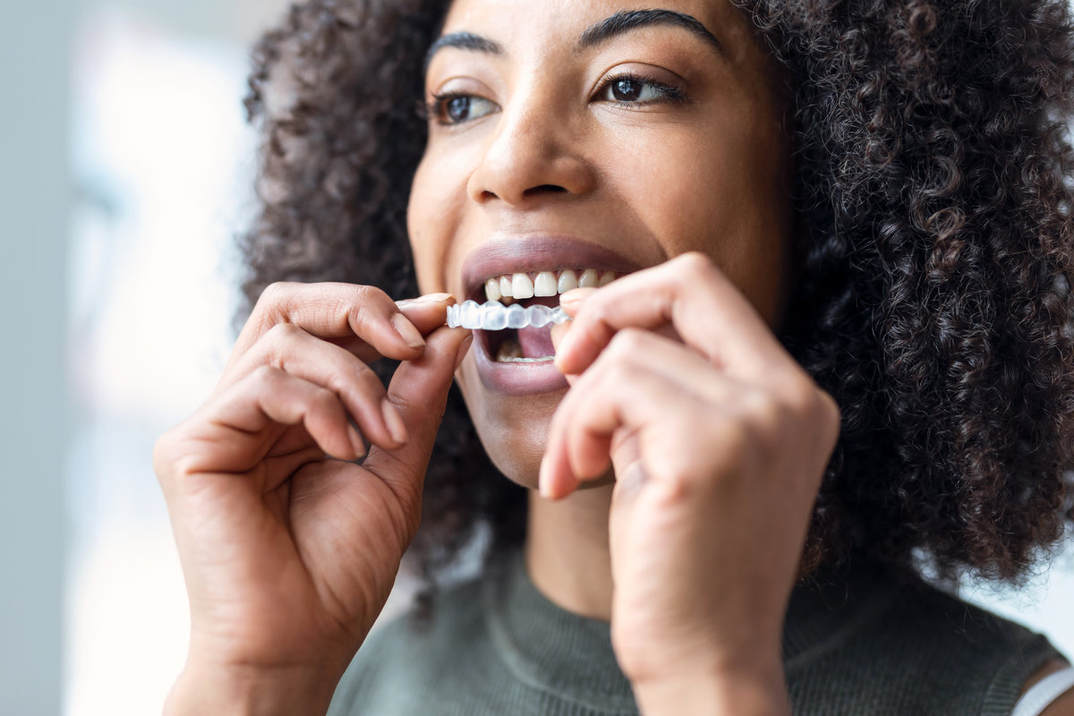 Woman wearing a clear Invisalign aligner tray, related to dental insurance coverage for Invisalign treatment